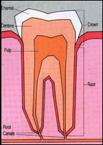 Tooth Decay